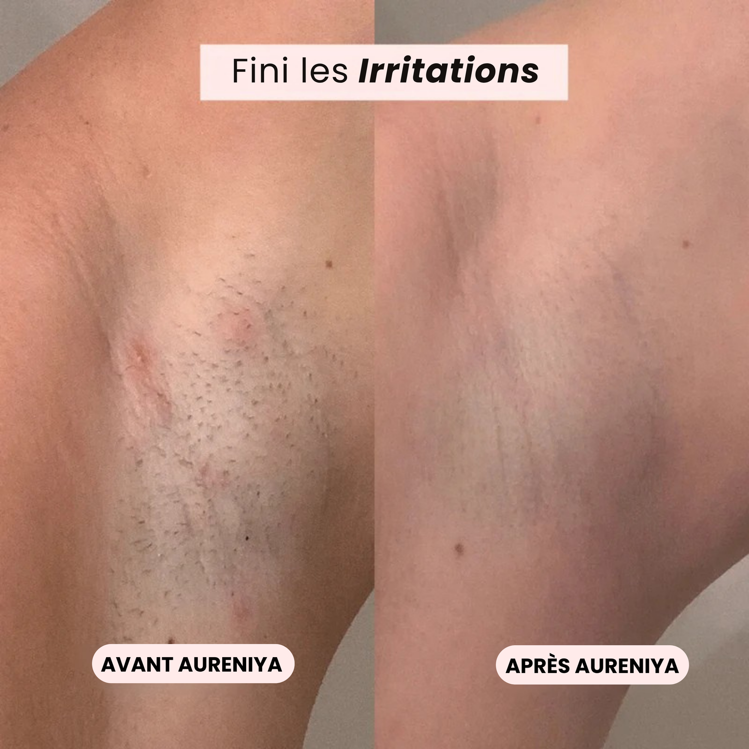 Rasoir Aureniya™